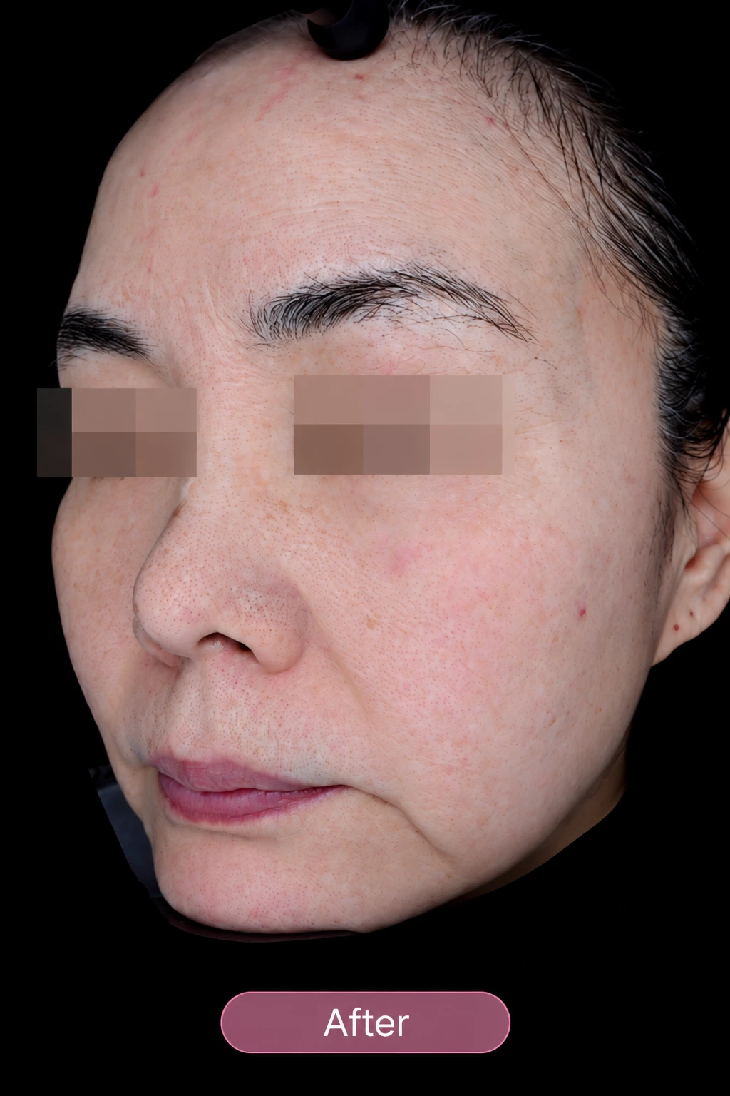 before_image