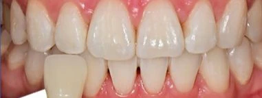 before_image