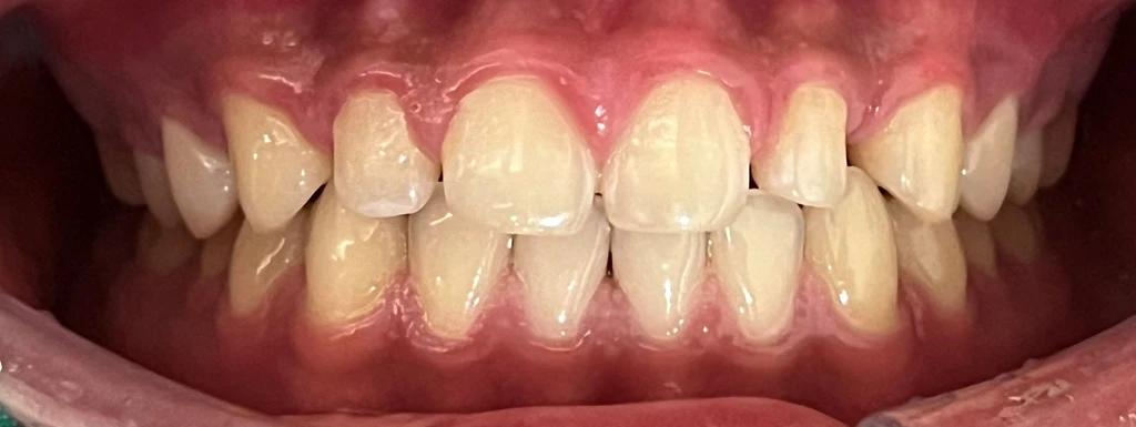 before_image