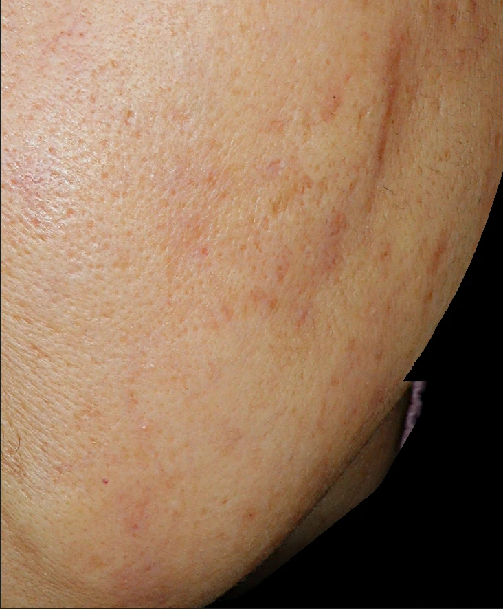 before_image