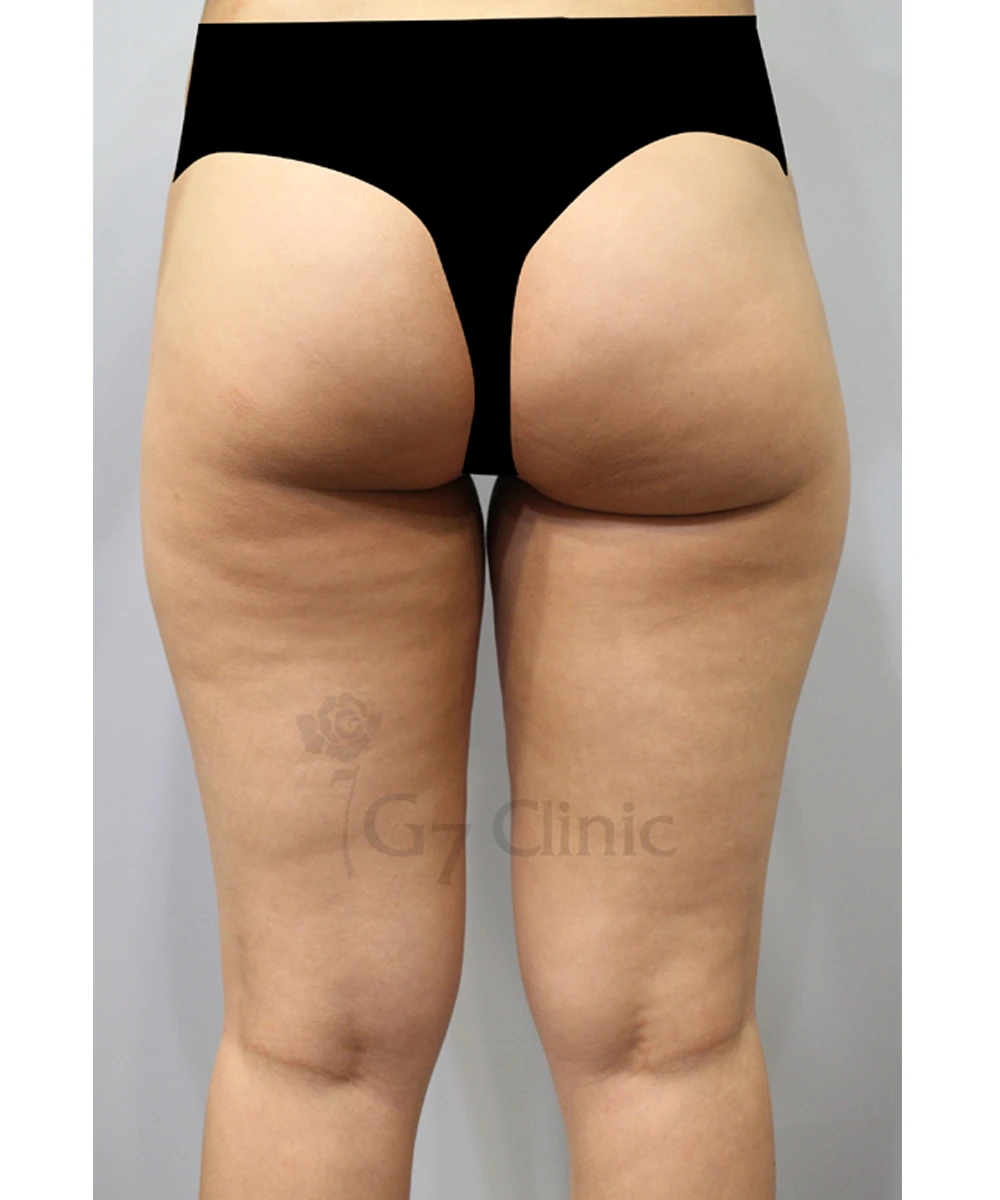 before_image