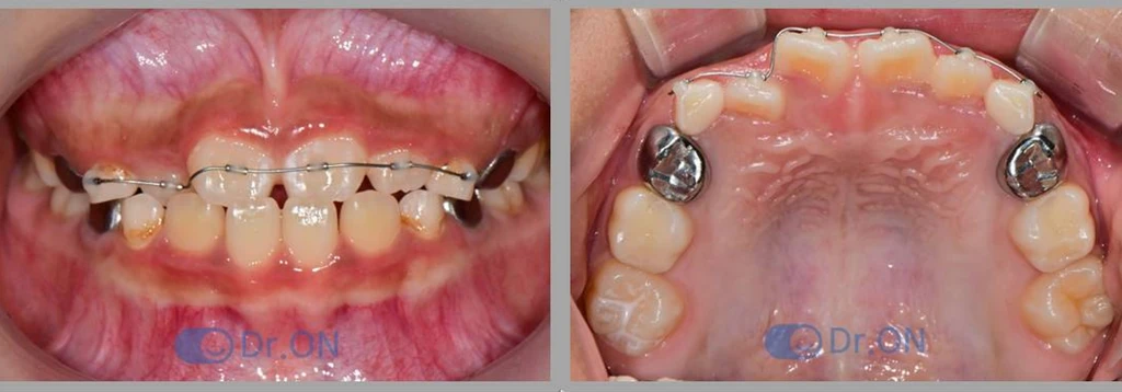 before_image