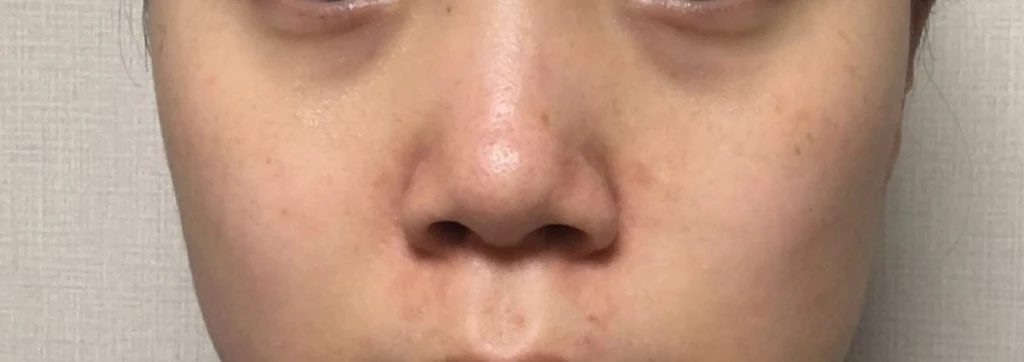 before_image