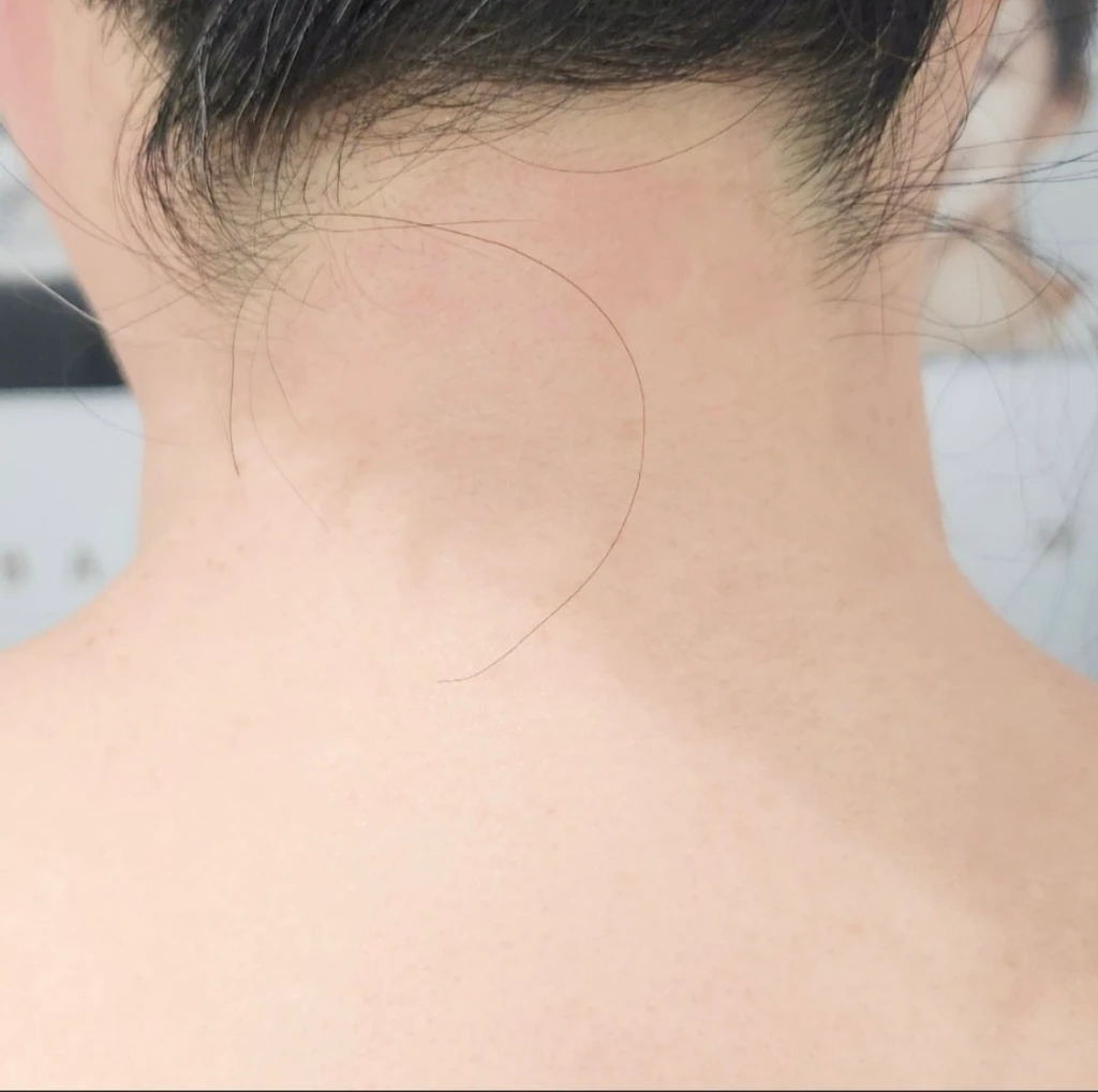 before_image