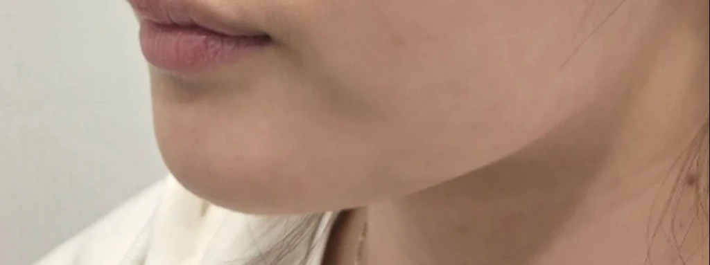before_image