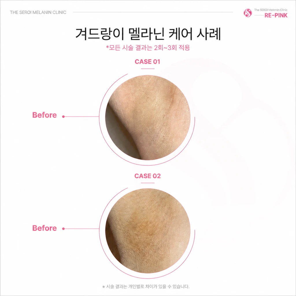 before_image