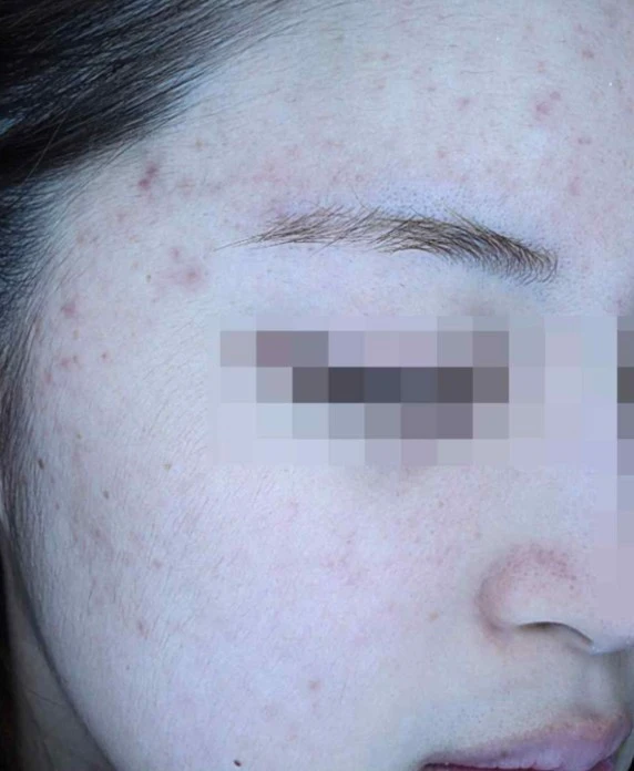 before_image