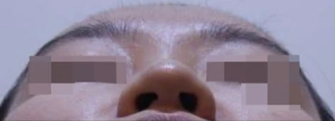 before_image