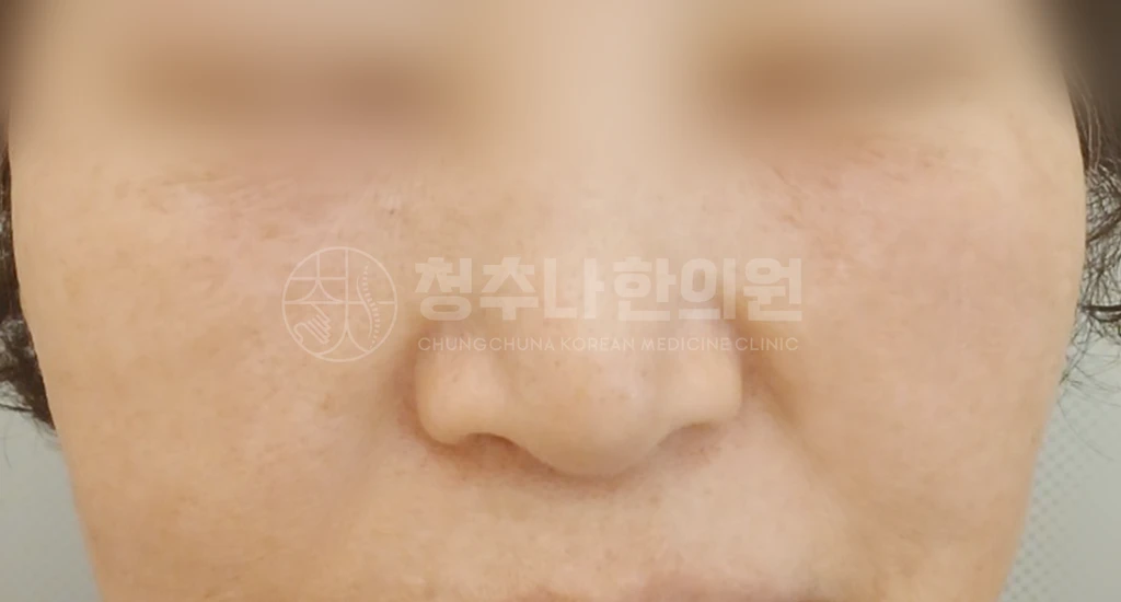 before_image