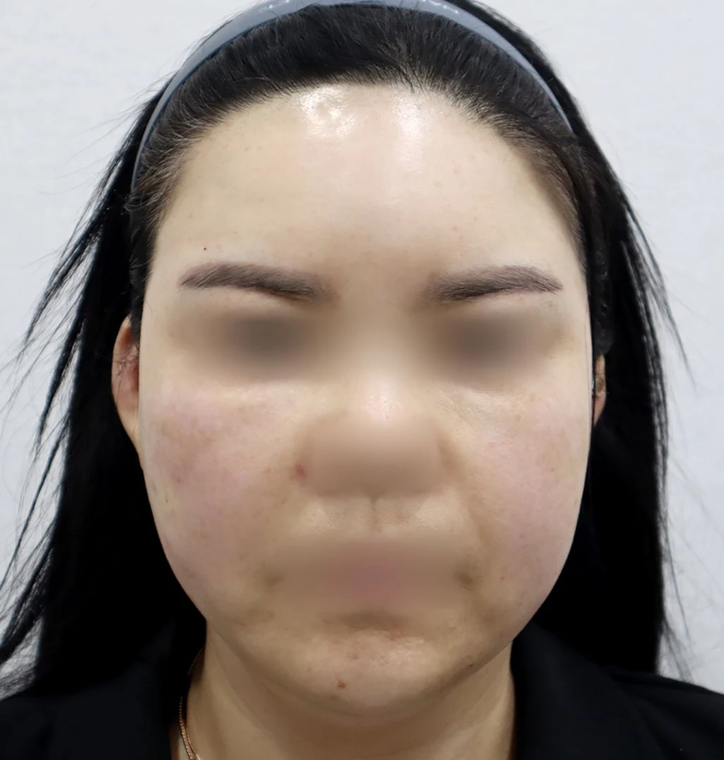 before_image
