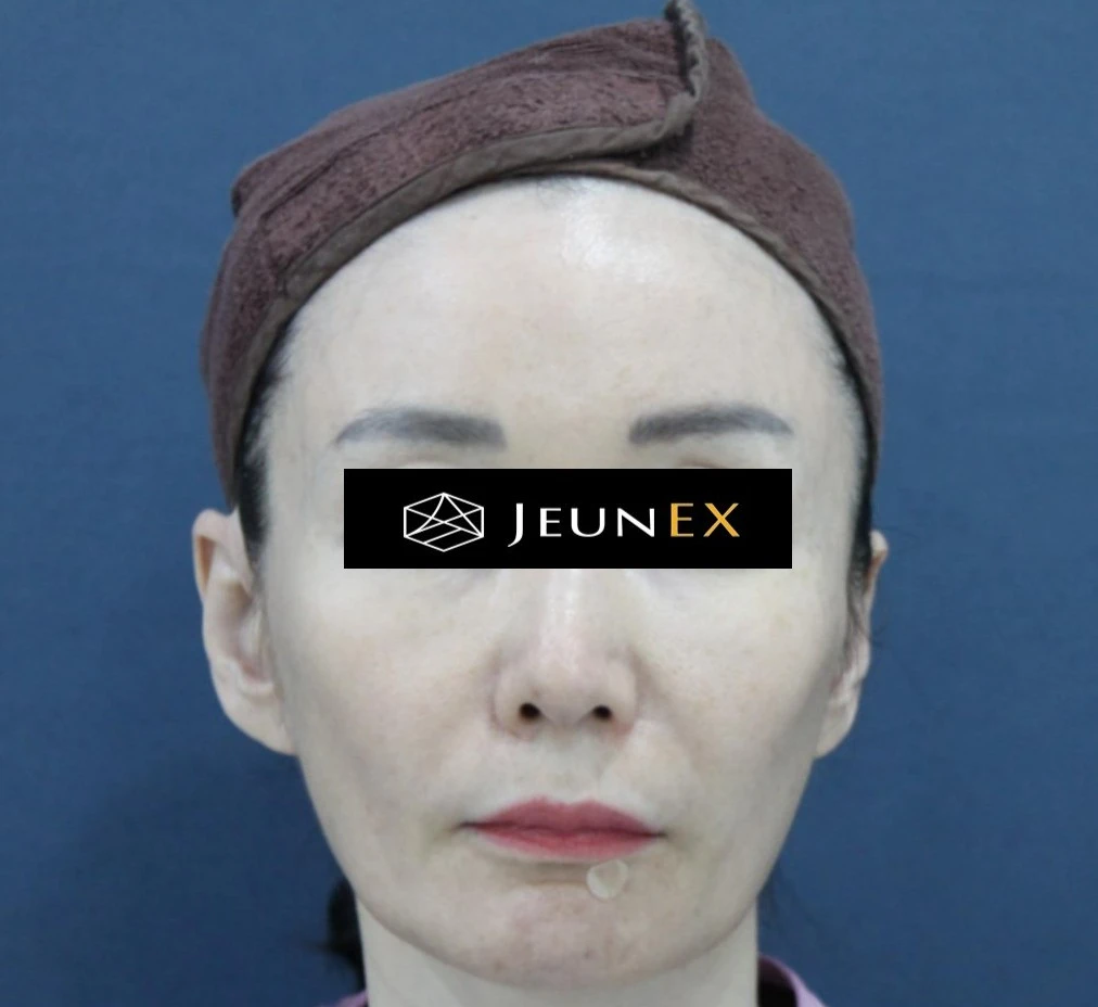 before_image