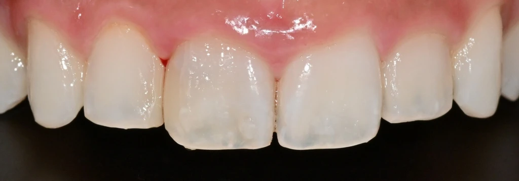 before_image