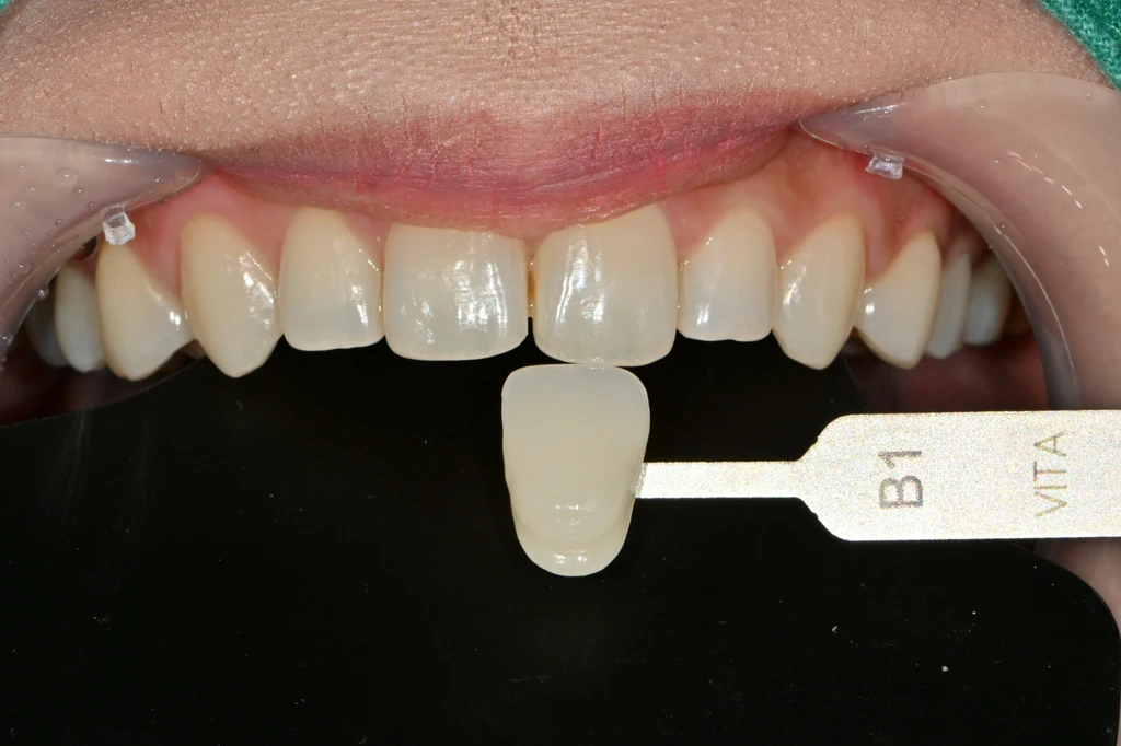 before_image