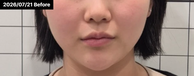 before_image