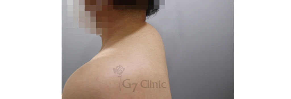 before_image