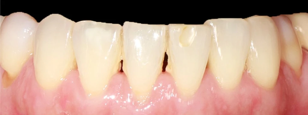 before_image