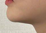 before_image