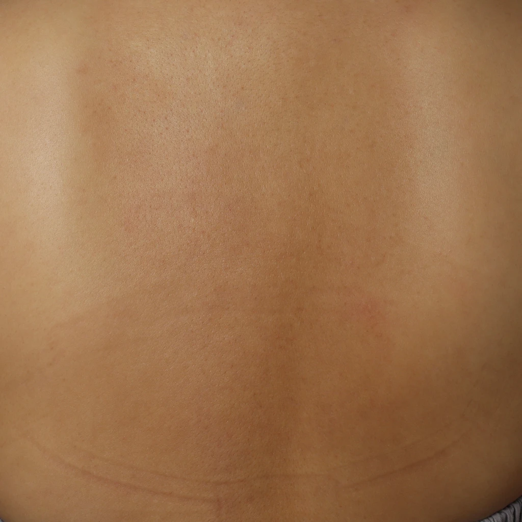 before_image