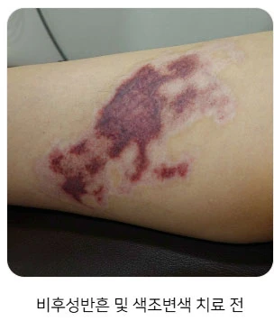 before_image