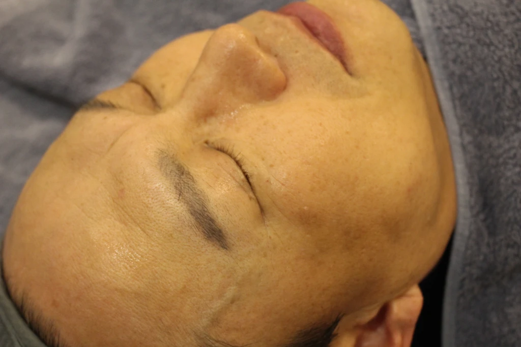 before_image