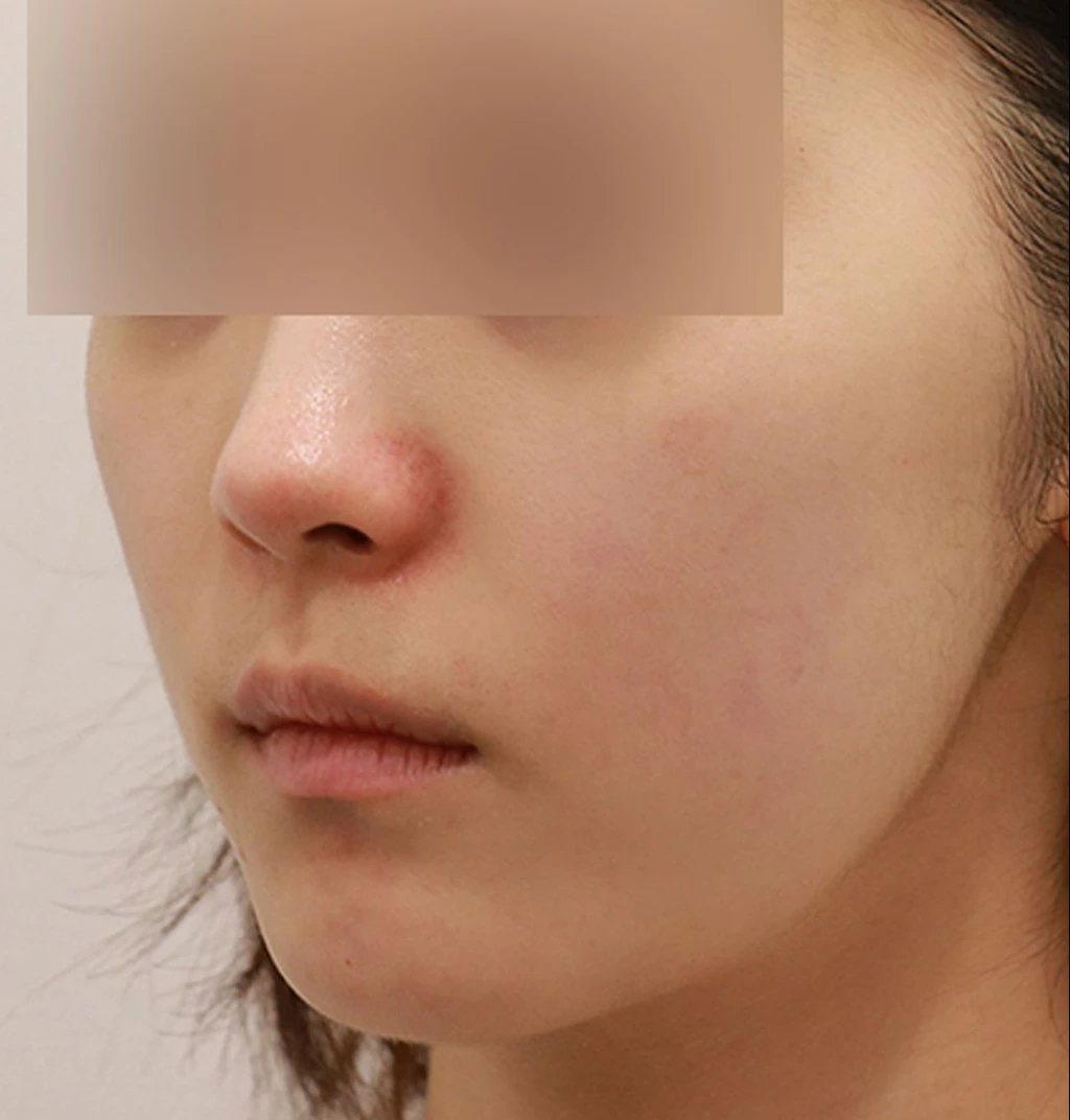 before_image