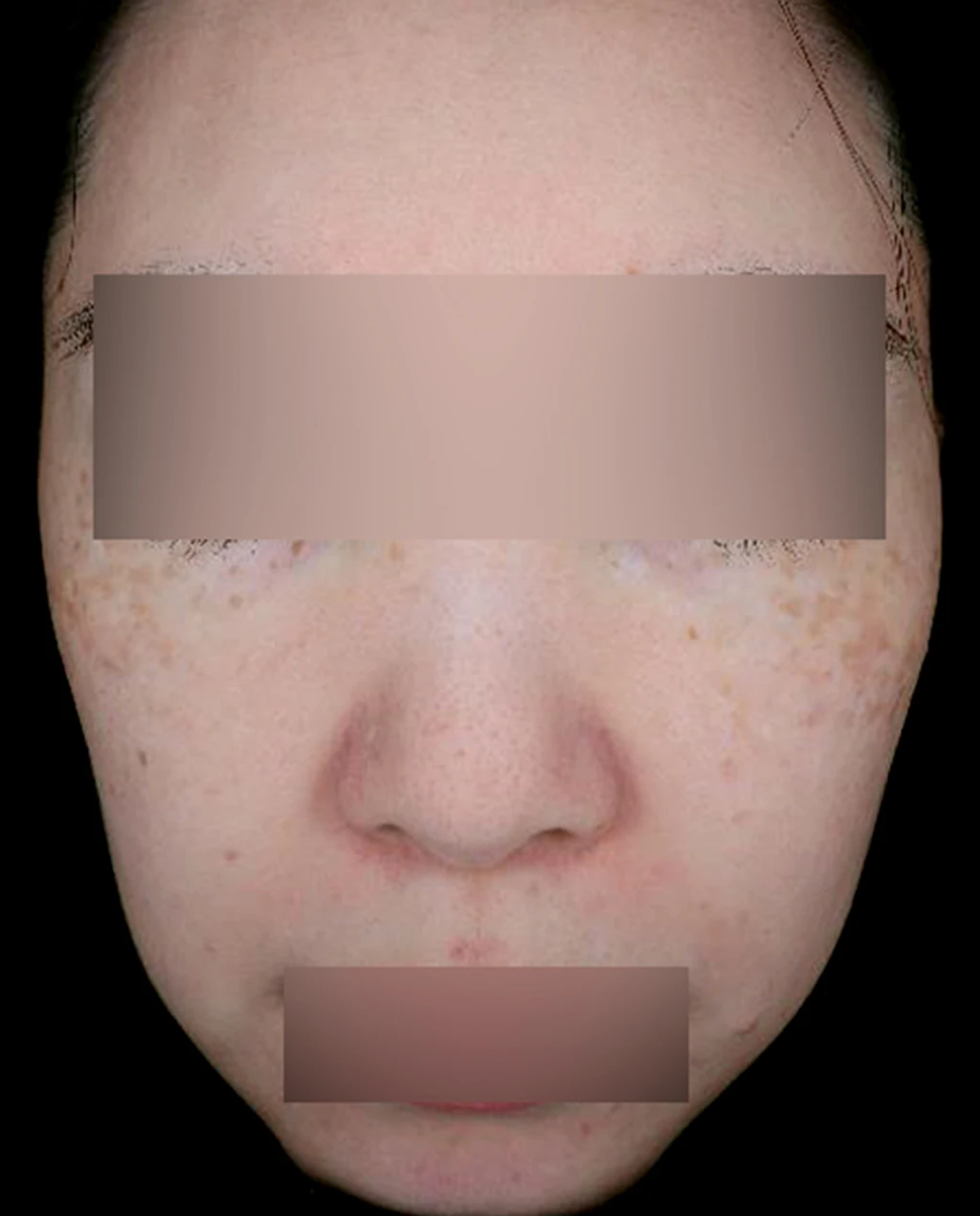 before_image