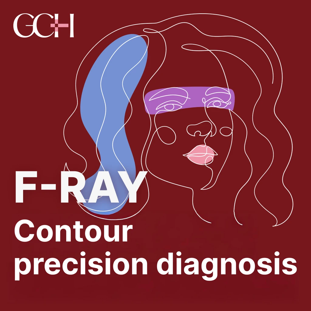 event thumbnail image