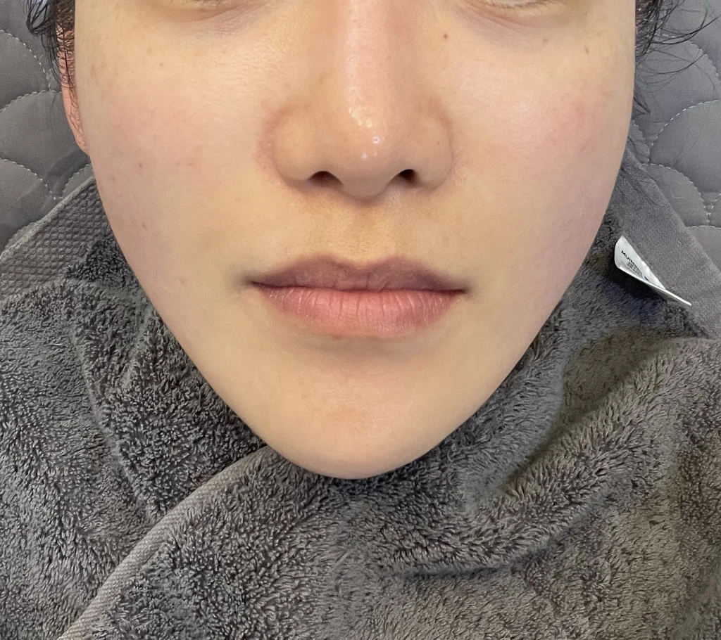 before_image