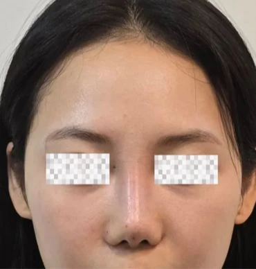 before_image