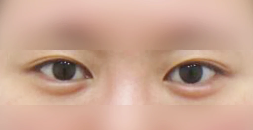 before_image