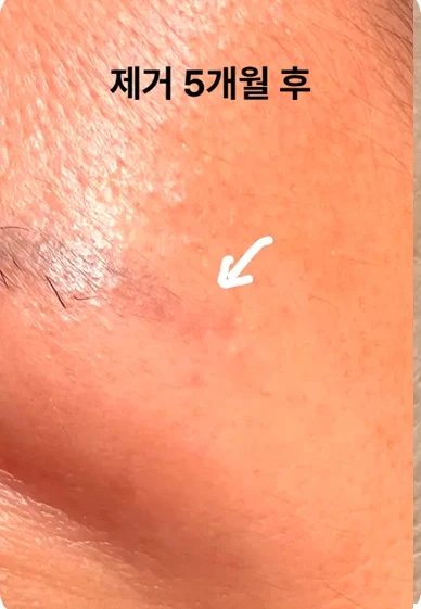 before_image