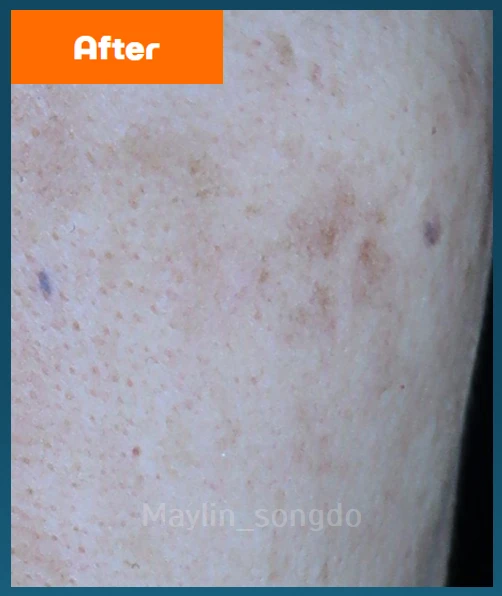 before_image