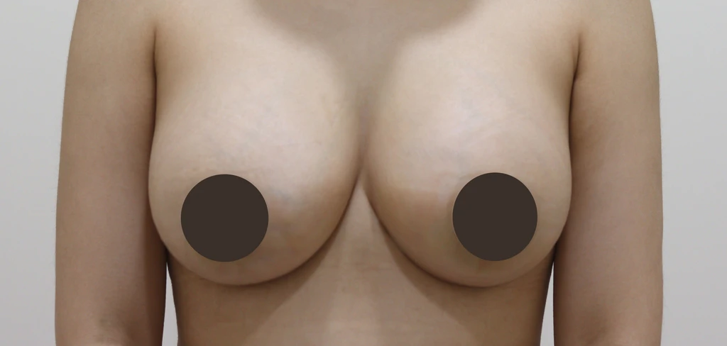 before_image