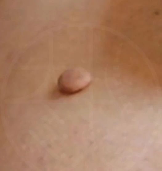 before_image