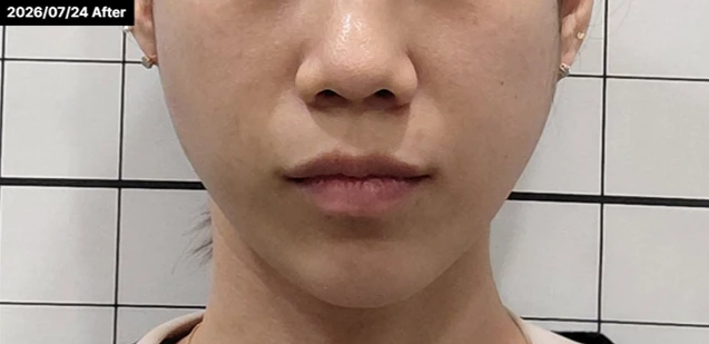 before_image