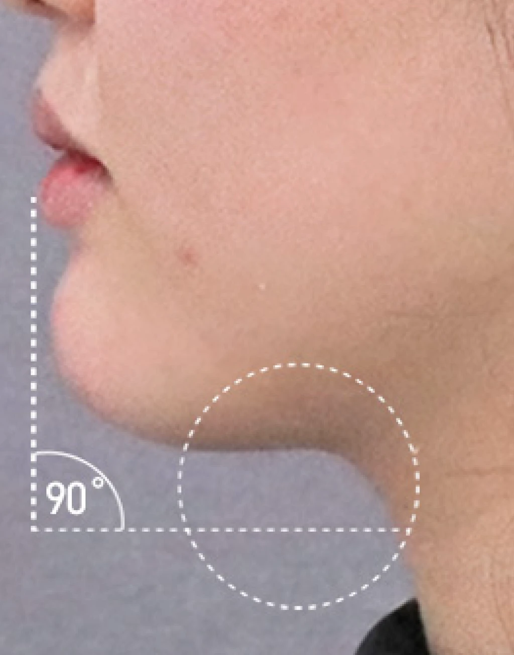 before_image