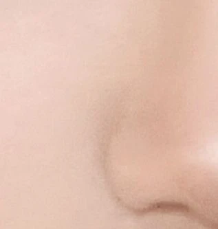 before_image