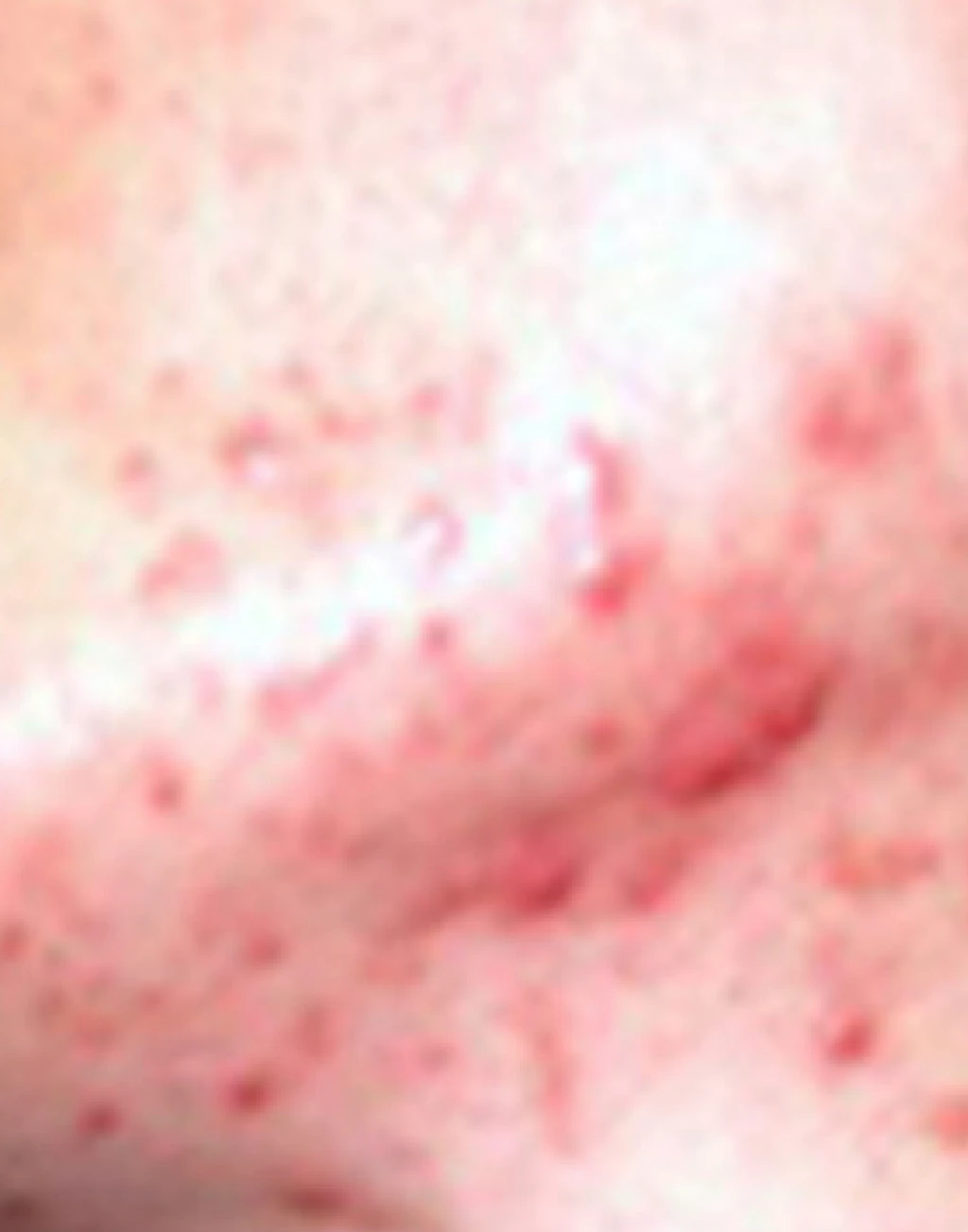before_image
