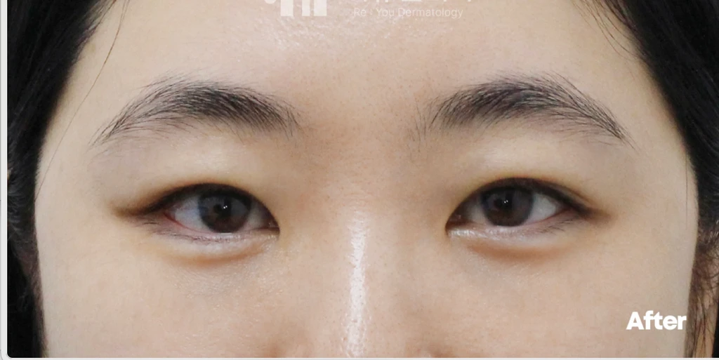 before_image