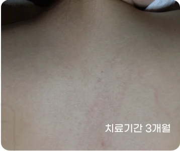 before_image
