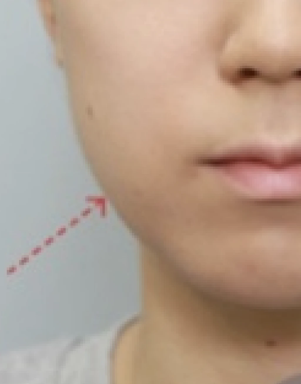 before_image