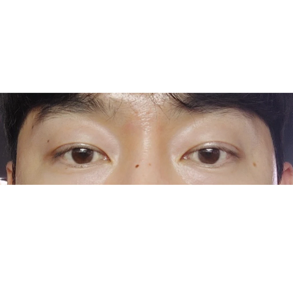 before_image