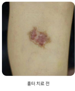 before_image