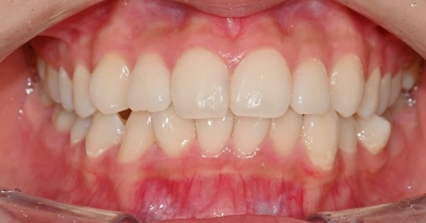 before_image