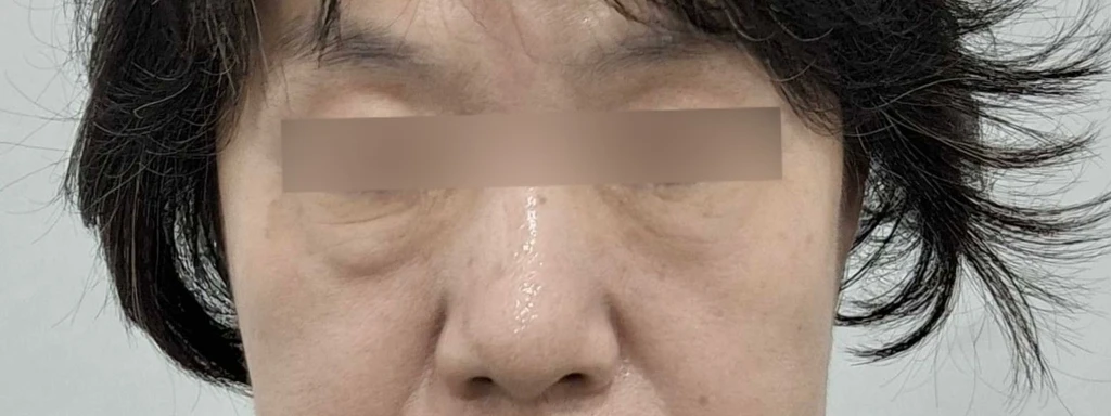 before_image