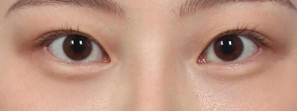 before_image