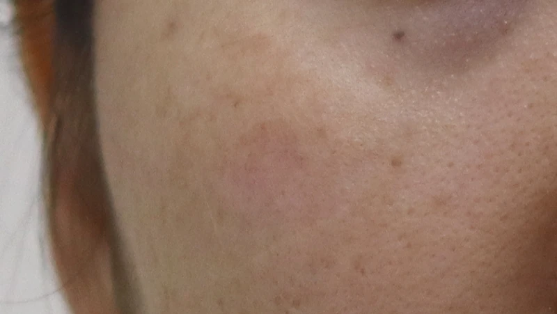 before_image