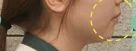 before_image