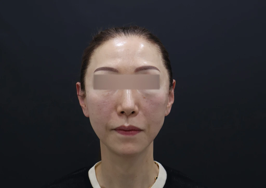 before_image