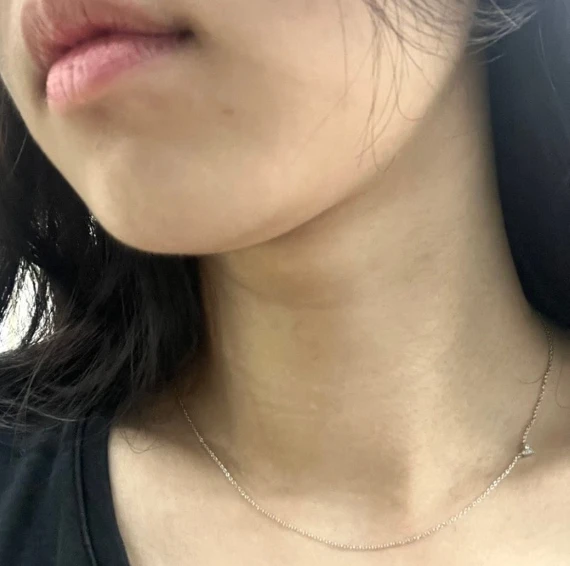 before_image